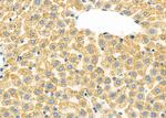 CFHR1 Antibody in Immunohistochemistry (Paraffin) (IHC (P))