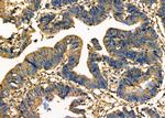 PDCD10 Antibody in Immunohistochemistry (Paraffin) (IHC (P))