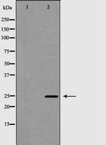 PDCD10 Antibody in Western Blot (WB)