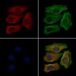 LAMP3 Antibody in Immunocytochemistry (ICC/IF)