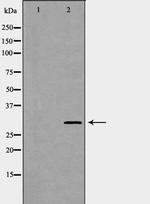 Kallikrein 2 Antibody in Western Blot (WB)