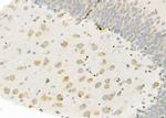 PIWIL2 Antibody in Immunohistochemistry (Paraffin) (IHC (P))