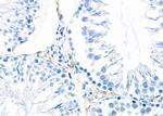 PIWIL2 Antibody in Immunohistochemistry (Paraffin) (IHC (P))