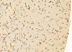 Rad52 Antibody in Immunohistochemistry (Paraffin) (IHC (P))