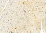 Rad52 Antibody in Immunohistochemistry (Paraffin) (IHC (P))