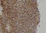 Rad52 Antibody in Immunohistochemistry (Paraffin) (IHC (P))