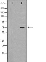 SCTR Antibody in Western Blot (WB)