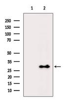 SFTPA1 Antibody in Western Blot (WB)