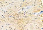 RRM2 Antibody in Immunohistochemistry (Paraffin) (IHC (P))