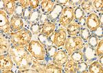 AHCY Antibody in Immunohistochemistry (Paraffin) (IHC (P))