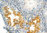 S100A12 Antibody in Immunohistochemistry (Paraffin) (IHC (P))