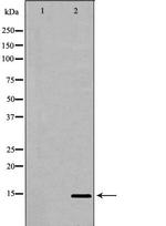 UTS2 Antibody in Western Blot (WB)