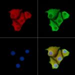 LTBR Antibody in Immunocytochemistry (ICC/IF)