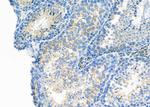 LTBR Antibody in Immunohistochemistry (Paraffin) (IHC (P))