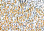 LTBR Antibody in Immunohistochemistry (Paraffin) (IHC (P))