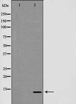 TCEB2 Antibody in Western Blot (WB)