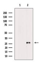 VAPB Antibody in Western Blot (WB)