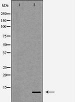 Diazepam Binding Inhibitor Antibody in Western Blot (WB)