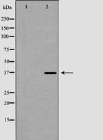 CD42a Antibody in Western Blot (WB)