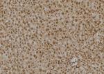 PSMC6 Antibody in Immunohistochemistry (Paraffin) (IHC (P))