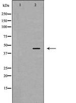 PSMC6 Antibody in Western Blot (WB)