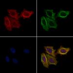 FBP1 Antibody in Immunocytochemistry (ICC/IF)