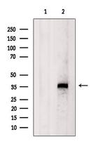 FBP1 Antibody in Western Blot (WB)