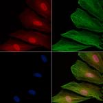 HUS1 Antibody in Immunocytochemistry (ICC/IF)