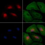 HEC1 Antibody in Immunocytochemistry (ICC/IF)