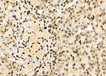 HEC1 Antibody in Immunohistochemistry (Paraffin) (IHC (P))