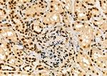 HEC1 Antibody in Immunohistochemistry (Paraffin) (IHC (P))