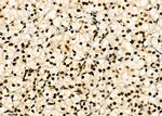 HEC1 Antibody in Immunohistochemistry (Paraffin) (IHC (P))