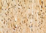 HEC1 Antibody in Immunohistochemistry (Paraffin) (IHC (P))