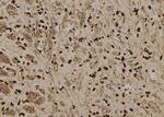 SERPINB3 Antibody in Immunohistochemistry (Paraffin) (IHC (P))