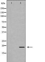 APRT Antibody in Western Blot (WB)