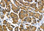 MTH1 Antibody in Immunohistochemistry (Paraffin) (IHC (P))