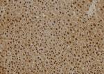 PSMB2 Antibody in Immunohistochemistry (Paraffin) (IHC (P))