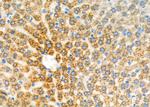 UGT1A4 Antibody in Immunohistochemistry (Paraffin) (IHC (P))