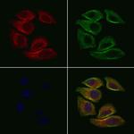 PNMT Antibody in Immunocytochemistry (ICC/IF)