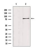 SH2B1 Antibody in Western Blot (WB)