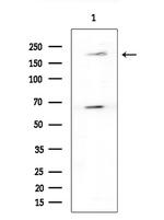 WNK3 Antibody in Western Blot (WB)