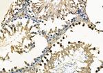 RABL2A Antibody in Immunohistochemistry (Paraffin) (IHC (P))