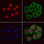 NSD3 Antibody in Immunocytochemistry (ICC/IF)