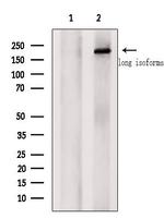 NSD3 Antibody in Western Blot (WB)