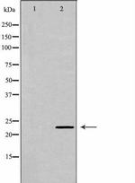 RAB6A Antibody in Western Blot (WB)