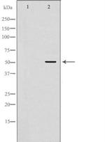 Fibrinogen gamma Antibody in Western Blot (WB)