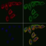 OCA2 Antibody in Immunocytochemistry (ICC/IF)