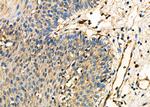 OCA2 Antibody in Immunohistochemistry (Paraffin) (IHC (P))