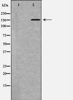 ATP7B Antibody in Western Blot (WB)