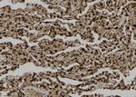 LATS2 Antibody in Immunohistochemistry (Paraffin) (IHC (P))